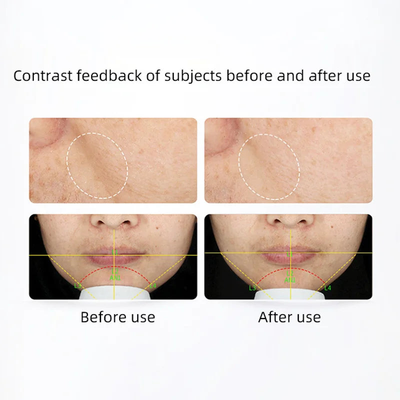 Murad Resurgence Retinol Cream 50ml Firming and Anti-Aging