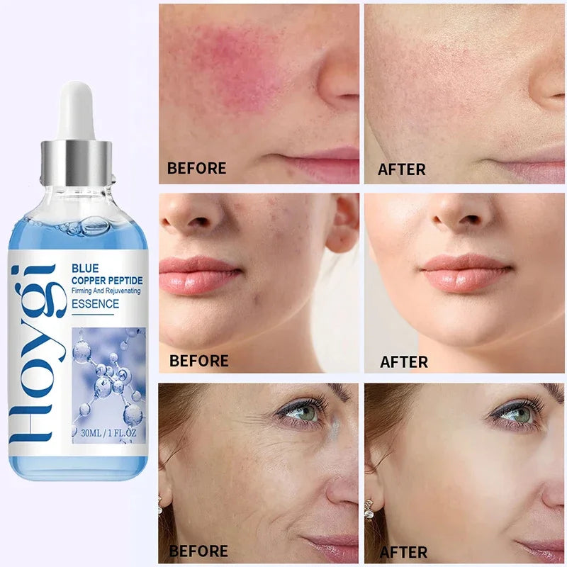 Hoygi Blue Copper Peptide Anti-Aging Serum