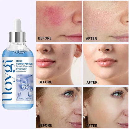 Hoygi Blue Copper Peptide Anti-Aging Serum