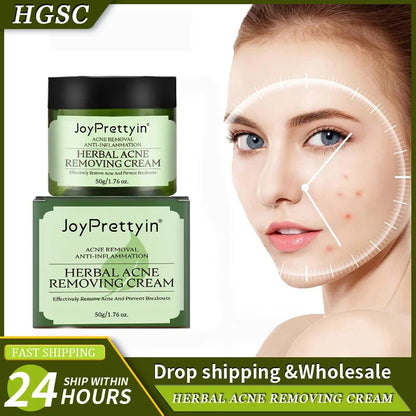 Natural Moisturizing Acne Treatment Cream