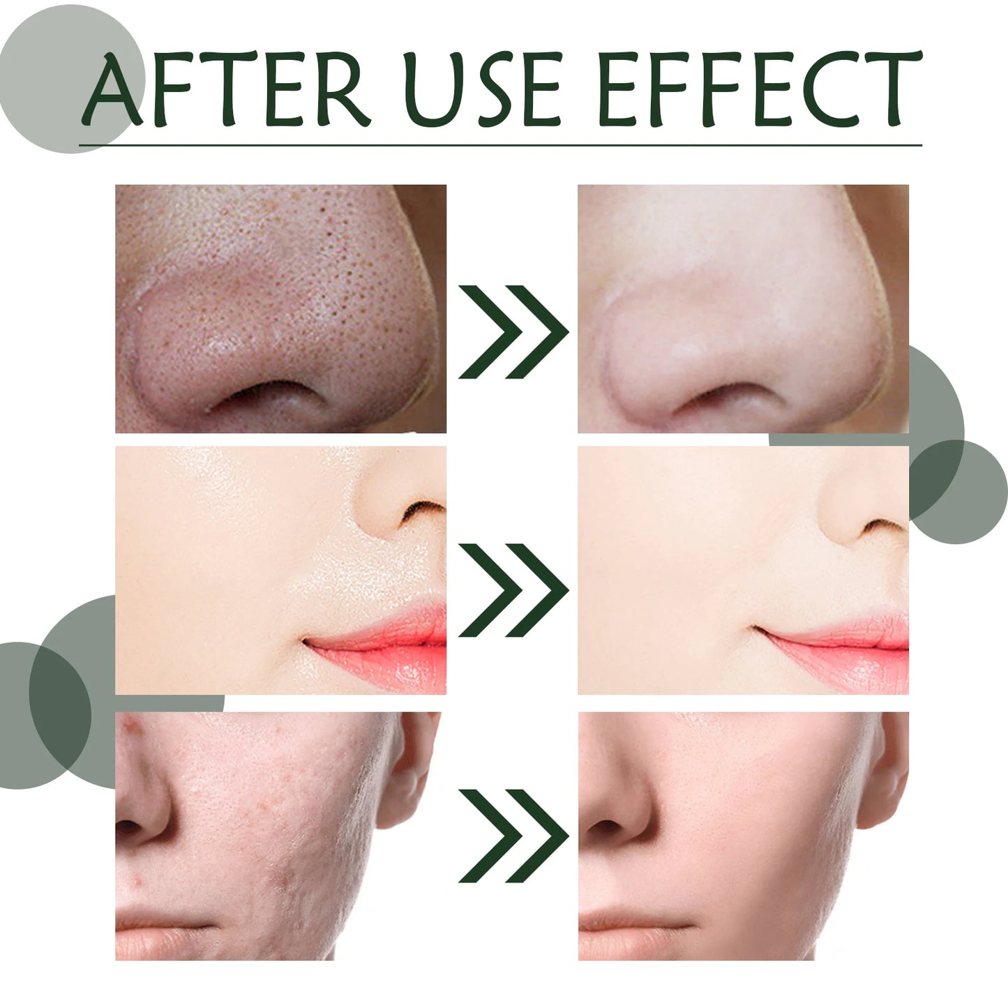 Hydrating Green Tea Blackhead Mask