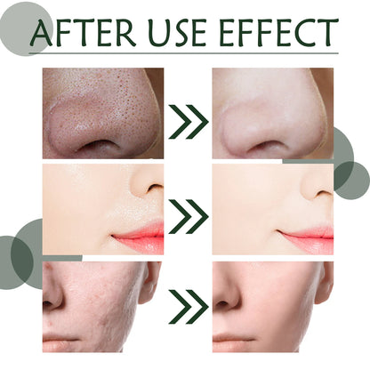 Hydrating Green Tea Blackhead Mask