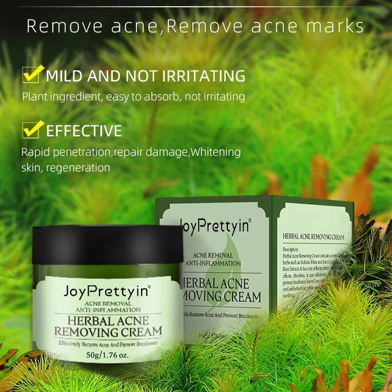 Natural Moisturizing Acne Treatment Cream