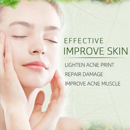 Natural Moisturizing Acne Treatment Cream