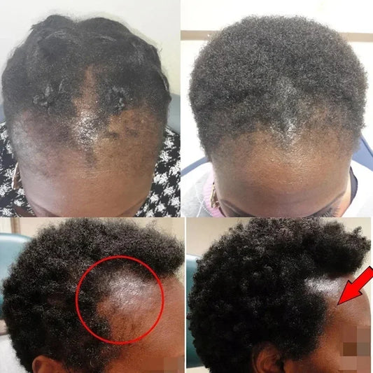 Natural Hair Care Batana Oil Repair