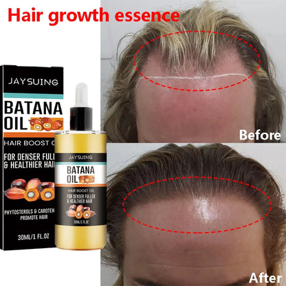 Batana Hair Mask Anti-Breakage Treatment