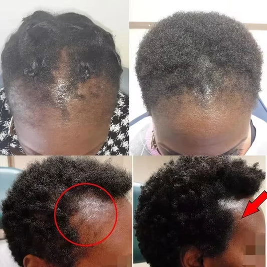 Batana Hair Mask Anti-Breakage Treatment
