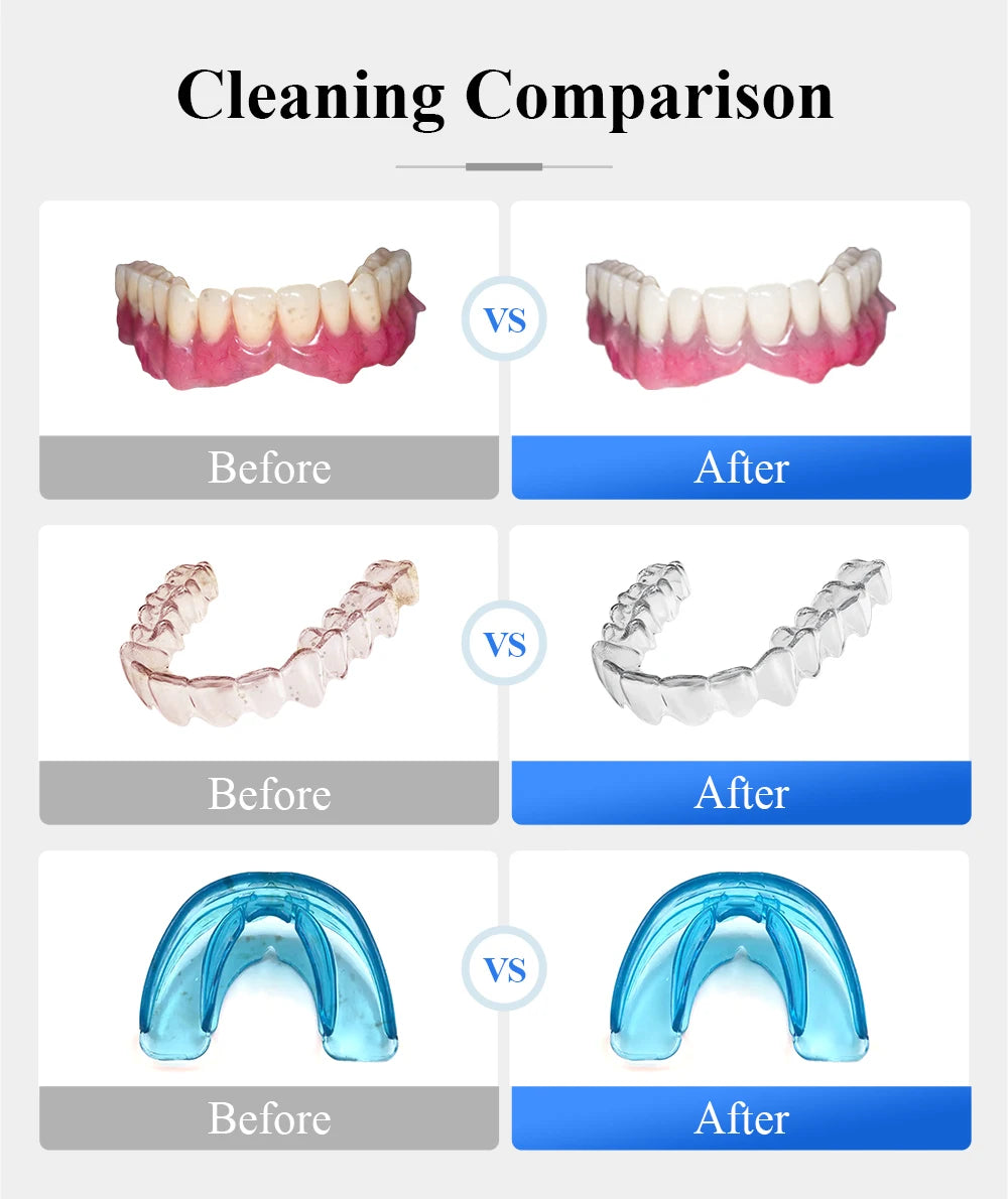 Tullker Ultrasonic Retainer Cleaner