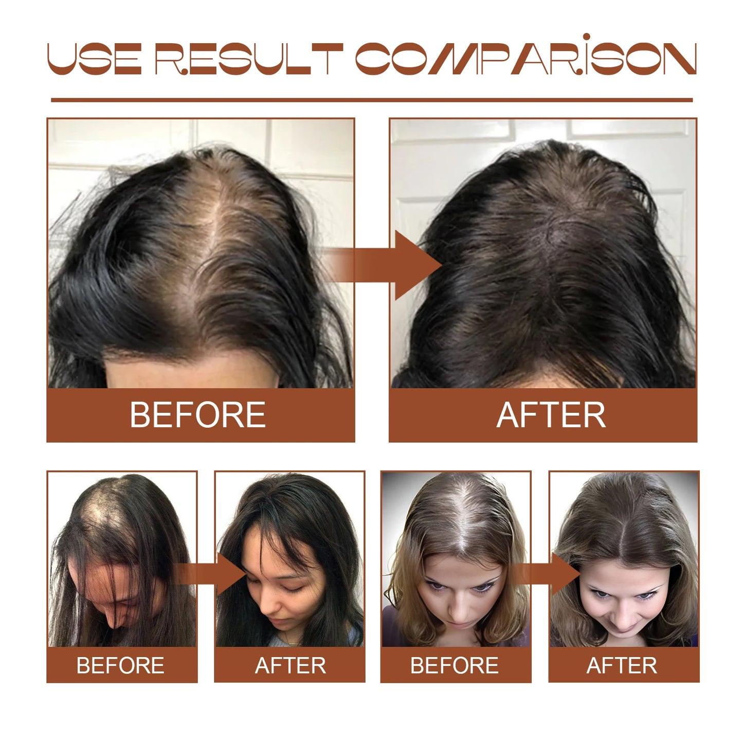 Natural Batana Oil Prevent Hair Loss