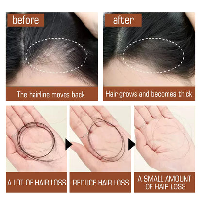 Natural Batana Oil Prevent Hair Loss