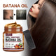 Natural Batana Oil Prevent Hair Loss