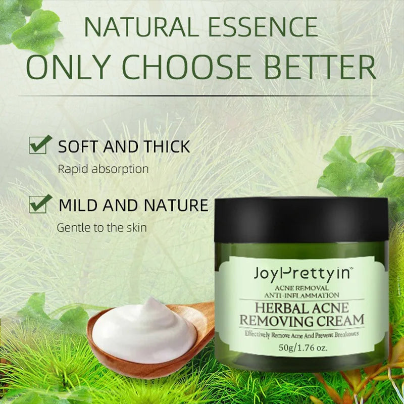 Natural Moisturizing Acne Treatment Cream